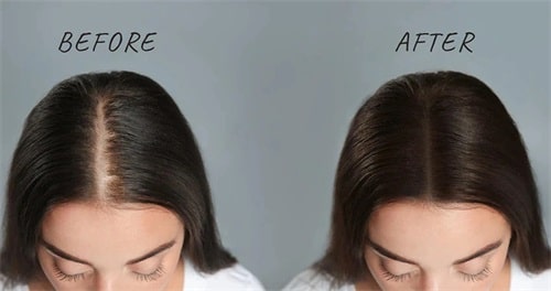 Is castor oil good for hair?