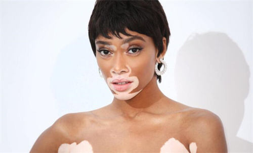 Winnie Harlow short hairstyles 