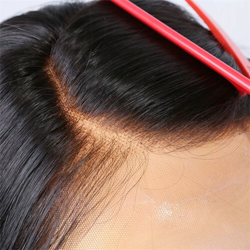 pluck hairline