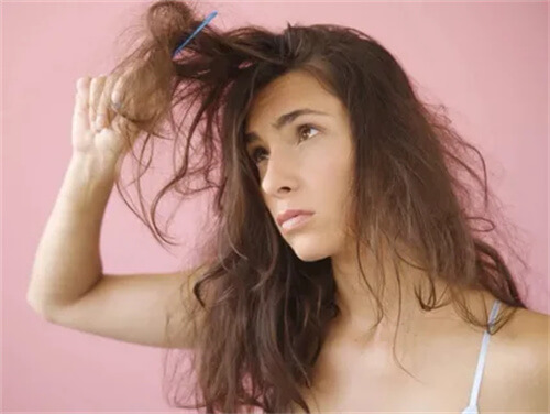 shedding hair