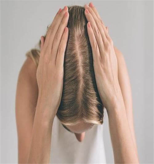 thinning hair