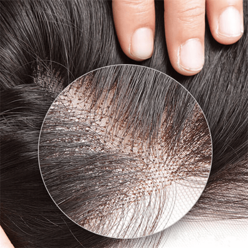what are wig knots